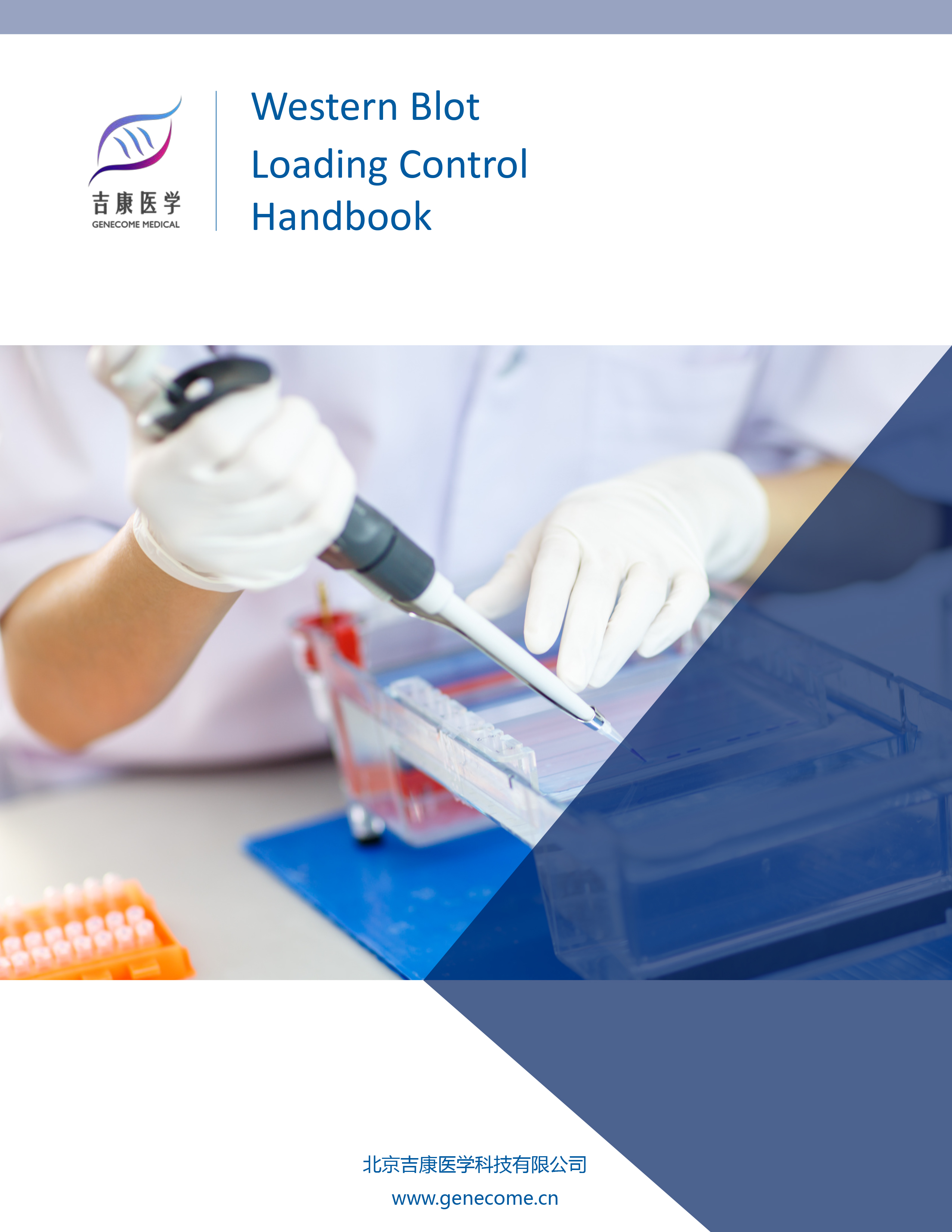 Western Blot内参抗体蛋白选择原则